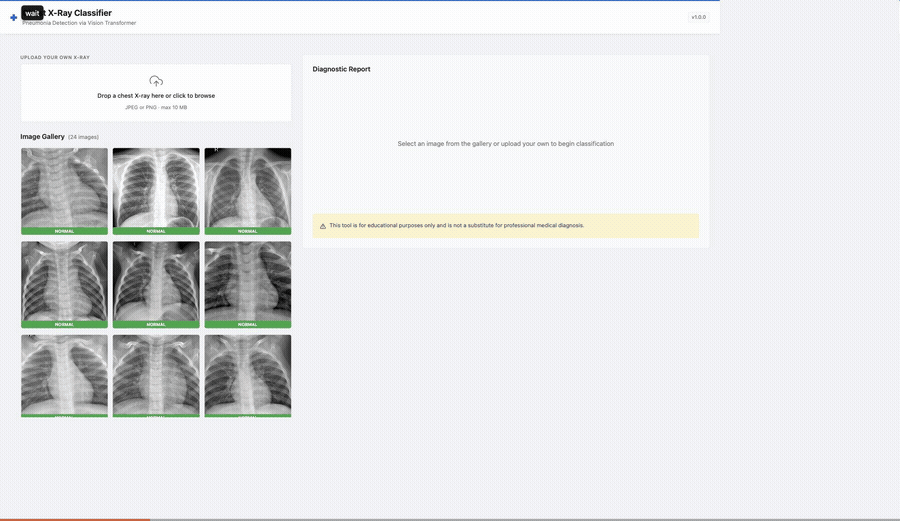 Selecting a chest X-ray from the gallery and viewing the pneumonia classification with Grad-CAM heatmap overlay